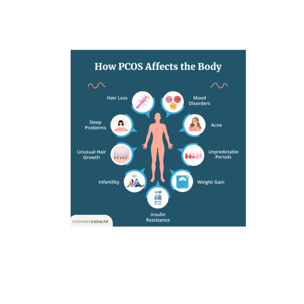 Polycystic ovary syndrome (PCOS)